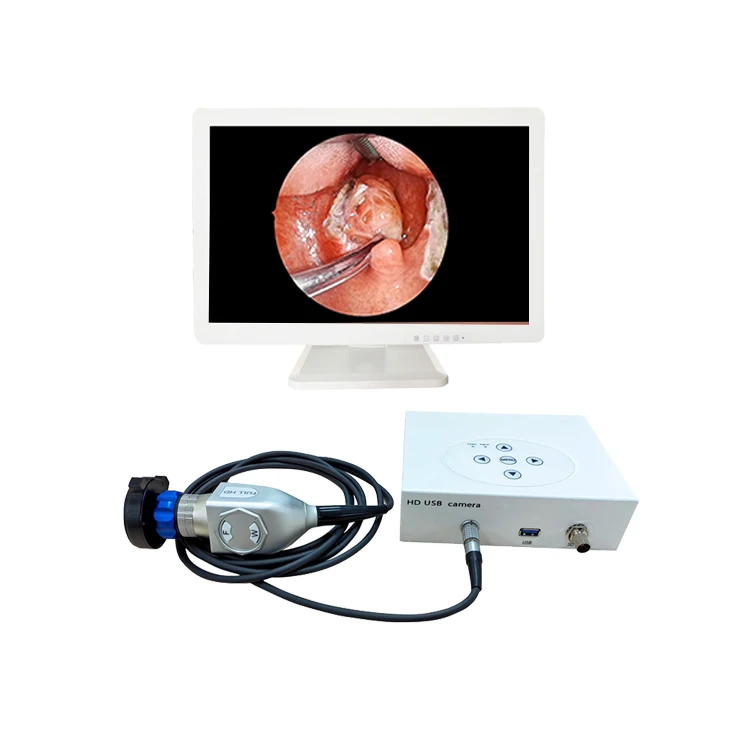 медицински ендоскоп HD USB преносима унг-камера и урологични цистоскопия гистероскопическая хирургична система